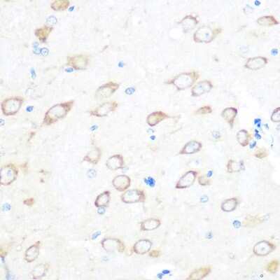 Immunohistochemistry-Paraffin: TPT1/TCTP Antibody (9H7S4) [NBP3-16122]
