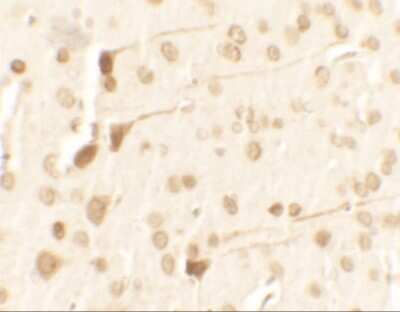Immunohistochemistry: TPT1/TCTP Antibody - BSA Free [NBP2-41206]