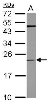 Western Blot: TPT1/TCTP Antibody [NBP2-20589]