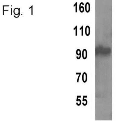 Western Blot: TPX2 Antibody (18D5-1) [NB100-74556]