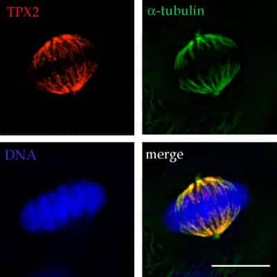 Immunocytochemistry/ Immunofluorescence: TPX2 Antibody [NB500-179]