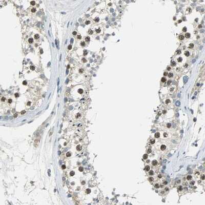 Immunohistochemistry-Paraffin: TPX2 Antibody [NBP1-88312]