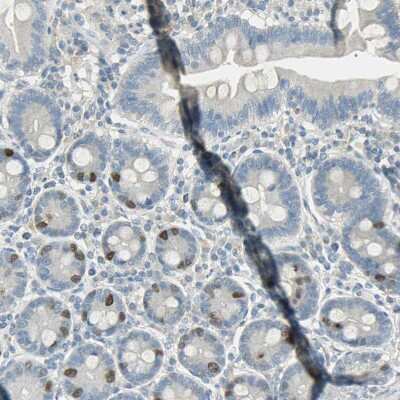 Immunohistochemistry-Paraffin: TPX2 Antibody [NBP1-88312]