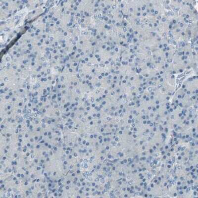 Immunohistochemistry-Paraffin: TPX2 Antibody [NBP1-88312]