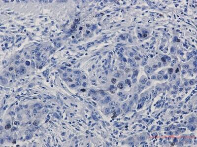 Immunohistochemistry-Paraffin: TPX2 Antibody (S01-8A6) [NBP3-19922]