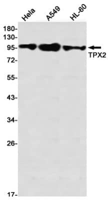 Western Blot: TPX2 Antibody (S01-8A6) [NBP3-19922]