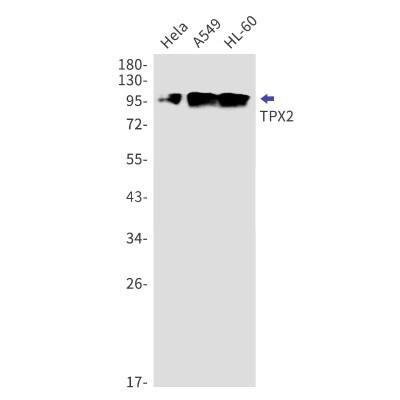 Western Blot: TPX2 Antibody (S05-1B5) [NBP3-19921]