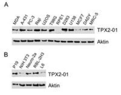 Western Blot: TPX2 Antibody (TPX2-01)BSA Free [NBP2-67265]