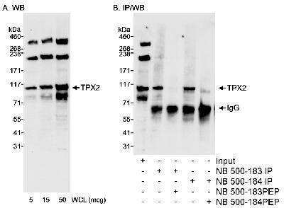 Western Blot: TPX2 Antibody [NB500-183]