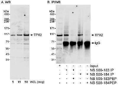 Western Blot: TPX2 Antibody [NB500-184]