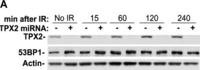 Western Blot: TPX2 Antibody [NB500-184]