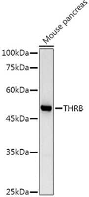 Western Blot: TR beta 1/NR1A2/Thyroid Hormone Receptor beta AntibodyAzide and BSA Free [NBP2-93985]