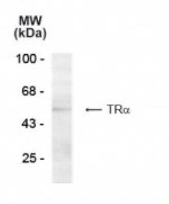 Western Blot: TR alpha/NR1A1/Thyroid Hormone Receptor alpha Antibody (1718) [NB200-318]