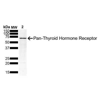 Western Blot: TR alpha/NR1A1/Thyroid Hormone Receptor alpha Antibody (H43) [NBP2-79822]