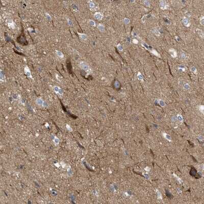 Immunohistochemistry-Paraffin: TR alpha/NR1A1/Thyroid Hormone Receptor alpha Antibody [NBP1-90118]