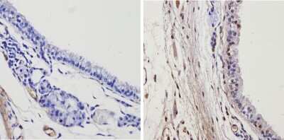 Immunohistochemistry-Paraffin: TR alpha/NR1A1/Thyroid Hormone Receptor alpha Antibody [NBP2-22523]