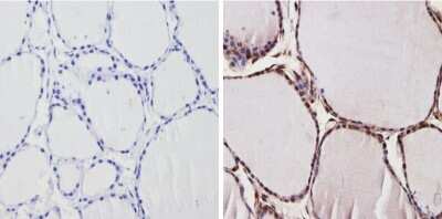 Immunohistochemistry-Paraffin: TR alpha/NR1A1/Thyroid Hormone Receptor alpha Antibody [NBP2-22523]