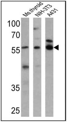 Western Blot: TR alpha/NR1A1/Thyroid Hormone Receptor alpha Antibody [NBP2-22523]