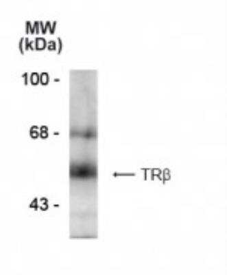 Western Blot: TR beta 1/NR1A2/Thyroid Hormone Receptor beta Antibody (2386) [NB100-61088]