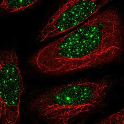 Immunocytochemistry/ Immunofluorescence: TR beta 1/NR1A2/Thyroid Hormone Receptor beta Antibody [NBP2-57253]