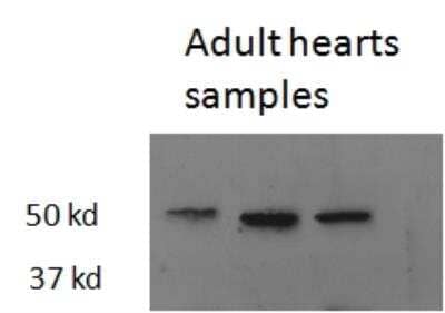 Western Blot: TR beta 1/NR1A2/Thyroid Hormone Receptor beta Antibody [NB100-93535]