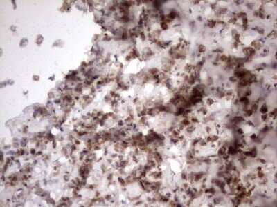 Immunohistochemistry: TR2/NR2C1 Antibody (OTI4C7) [NBP2-46227]