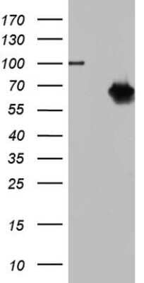 Western Blot: TR2/NR2C1 Antibody (OTI4C7) [NBP2-46227]