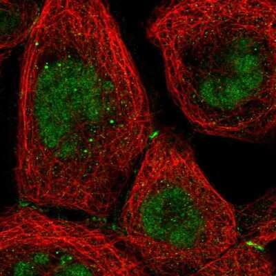 Immunocytochemistry/ Immunofluorescence: TR2/NR2C1 Antibody [NBP2-55132]