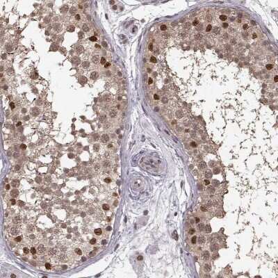 Immunohistochemistry-Paraffin: TR2/NR2C1 Antibody [NBP2-56277]
