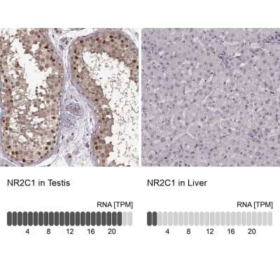 Immunohistochemistry-Paraffin: TR2/NR2C1 Antibody [NBP2-56277]