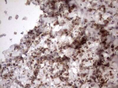 Immunohistochemistry: TR2/NR2C1 Antibody (OTI4C7) - Azide and BSA Free [NBP2-74576]