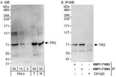 Western Blot: TR2/NR2C1 Antibody [NBP1-71803]