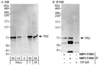 Western Blot: TR2/NR2C1 Antibody [NBP1-71804]