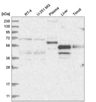 Western Blot: TR2/NR2C1 Antibody [NBP2-55133]