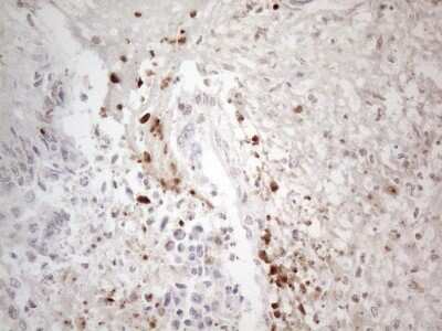 Immunohistochemistry: TR4/NR2C2 Antibody (OTI4B1) [NBP2-46228]