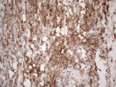 Immunohistochemistry: TR4/NR2C2 Antibody (OTI4B1) [NBP2-46228]