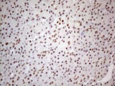 Immunohistochemistry: TR4/NR2C2 Antibody (OTI4B1) [NBP2-46228]