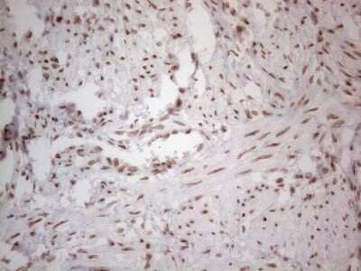 Immunohistochemistry: TR4/NR2C2 Antibody (OTI4B1) [NBP2-46228]