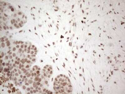 Immunohistochemistry: TR4/NR2C2 Antibody (OTI4B1) [NBP2-46228]
