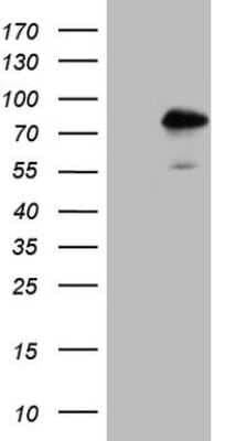 Western Blot: TR4/NR2C2 Antibody (OTI4B1) [NBP2-46228]