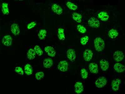 Immunocytochemistry/ Immunofluorescence: TR4/NR2C2 Antibody [NBP2-97138]