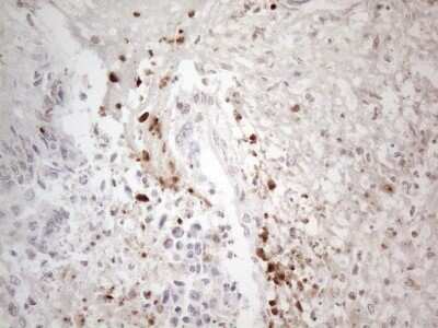 Immunohistochemistry: TR4/NR2C2 Antibody (OTI4B1) - Azide and BSA Free [NBP2-74577]