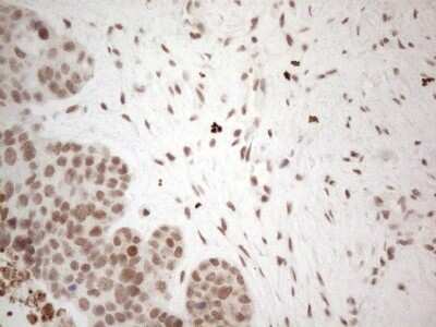 Immunohistochemistry: TR4/NR2C2 Antibody (OTI4B1) - Azide and BSA Free [NBP2-74577]