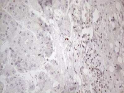 Immunohistochemistry: TR4/NR2C2 Antibody (OTI4B1) - Azide and BSA Free [NBP2-74577]