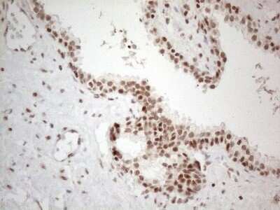 Immunohistochemistry: TR4/NR2C2 Antibody (OTI4B1) - Azide and BSA Free [NBP2-74577]