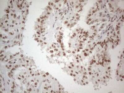 Immunohistochemistry: TR4/NR2C2 Antibody (OTI4B1) - Azide and BSA Free [NBP2-74577]