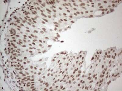 Immunohistochemistry: TR4/NR2C2 Antibody (OTI4B1) - Azide and BSA Free [NBP2-74577]