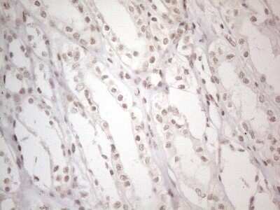 Immunohistochemistry: TR4/NR2C2 Antibody (OTI4B1) - Azide and BSA Free [NBP2-74577]