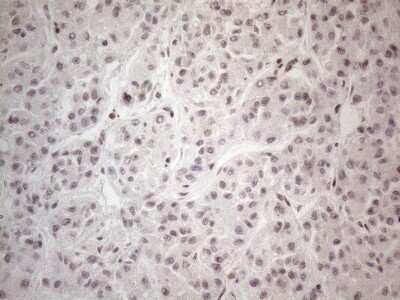 Immunohistochemistry: TR4/NR2C2 Antibody (OTI4B1) - Azide and BSA Free [NBP2-74577]