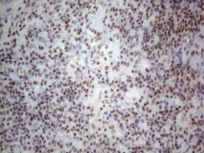 Immunohistochemistry: TR4/NR2C2 Antibody (OTI4B1) - Azide and BSA Free [NBP2-74577]